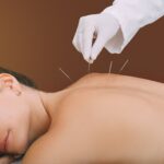 Balancing Body and Mind: Acupuncture for Fertility Wellness